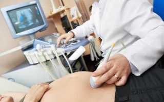 О чём говорит повышенное содержание лейкоцитов в моче при беременности