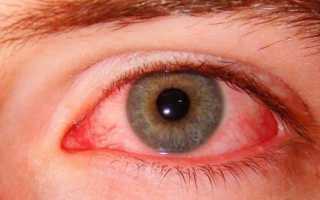 Глазное давление – лечение
