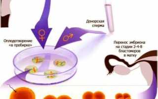 Какие анализы нужно сдать для ЭКО