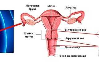 Вакцина от папилломы шейки матки