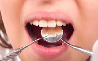 Советы по лечению или удалению зуба во время менструации