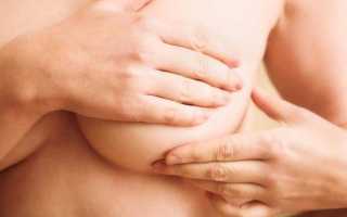 Массаж молочных желез при мастопатии