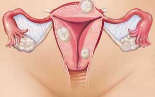 Дозировка флуконазола при молочнице у женщин