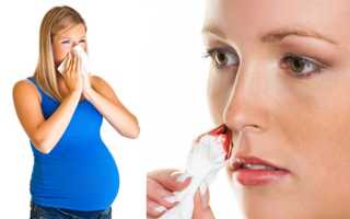 Причины крови из носа при беременности третий триместр