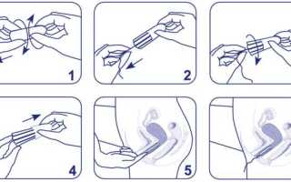 Как правильно ставить тампон при месячных