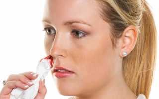 Причины кровотечения из носа  у взрослого при нормальном состоянии