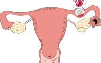 Диагностика беременности во время осмотра гинекологом
