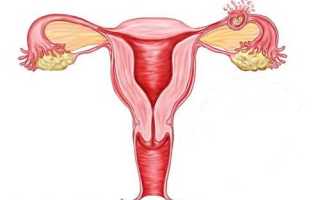 Как проявляется внематочная беременность