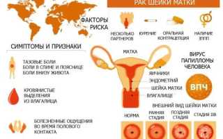 Первые признаки и симптомы рака шейки матки